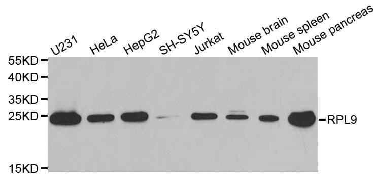 Polyclonal Rabbit anti-Human RPL9 / Ribosomal Protein L9 Antibody (IHC, IF, WB)