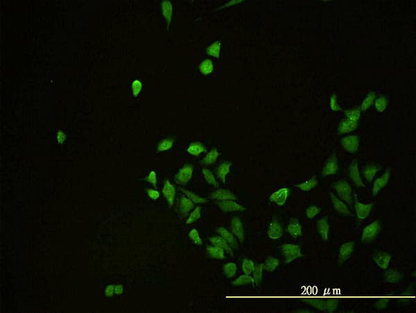 IHC-plus™ Monoclonal Mouse anti-Human CD58 Antibody (clone 2D11-B10, IHC, IF, WB)