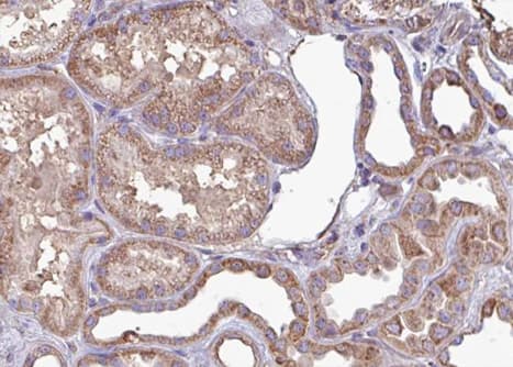 CAMK2A / CaMKII Alpha Antibody (phospho-Thr286)