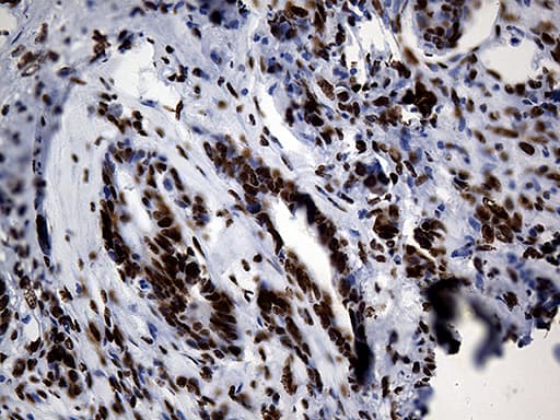 HNRNPH1 / hnRNP H Antibody (clone OTI5D11)