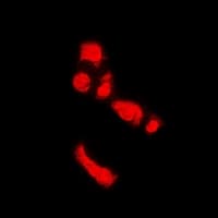 Polyclonal Rabbit anti-Human PADI4 / PAD4 Antibody (IHC, IF, WB)