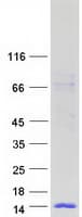 Human WFDC6 Protein (Recombinant Myc-DDK (Flag))