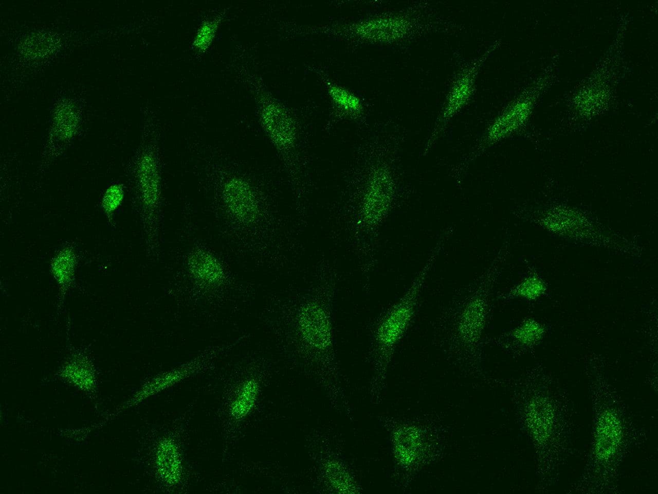 ATR Antibody