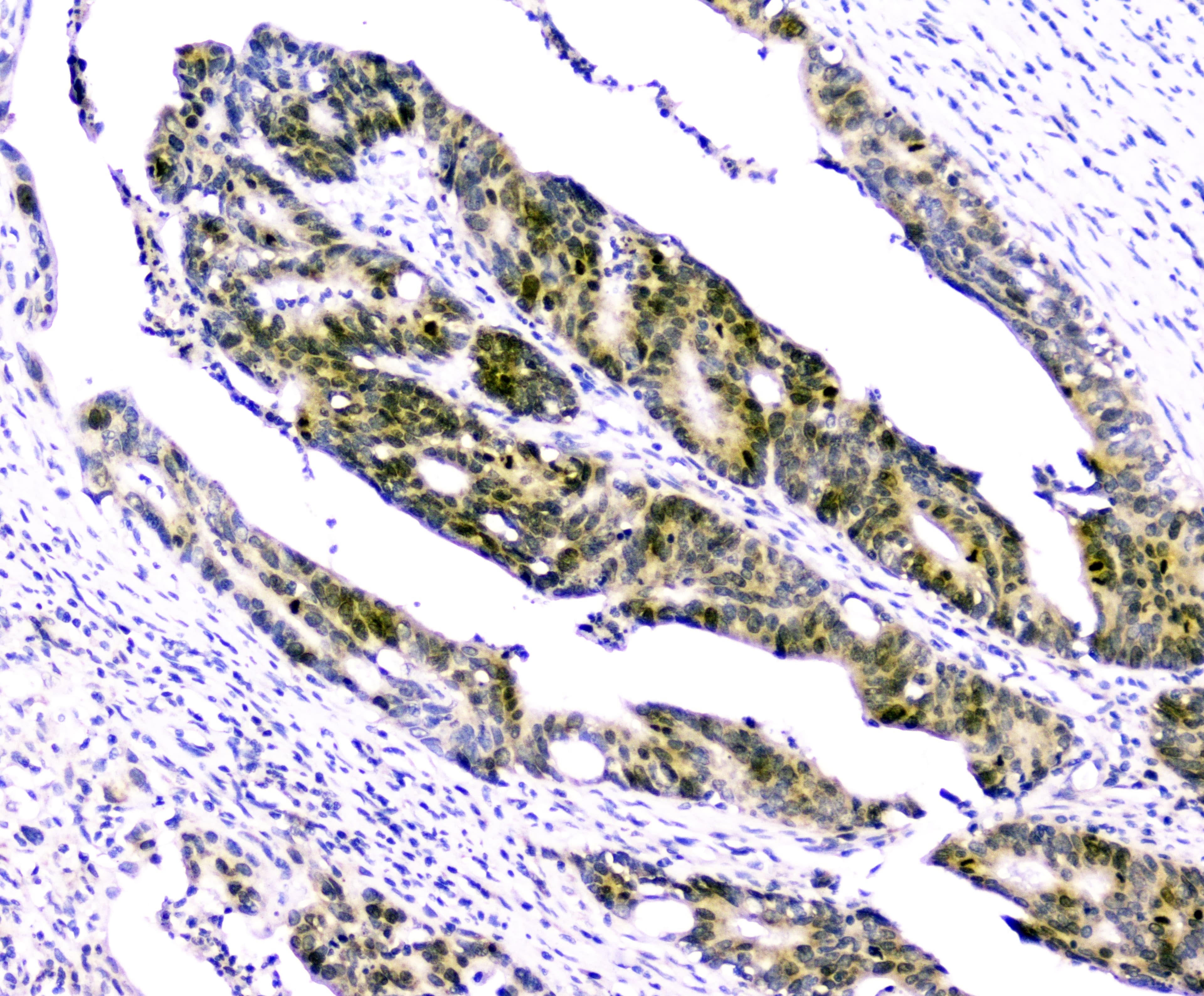 BIRC5 / Survivin Antibody