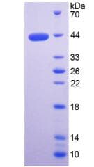 Human WFDC2 / HE4 Protein (Recombinant His-GST)