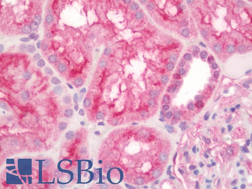 IHC-plus™ Polyclonal Rabbit anti-Human MME / CD10 Antibody (aa274-302, IHC, IF, WB)