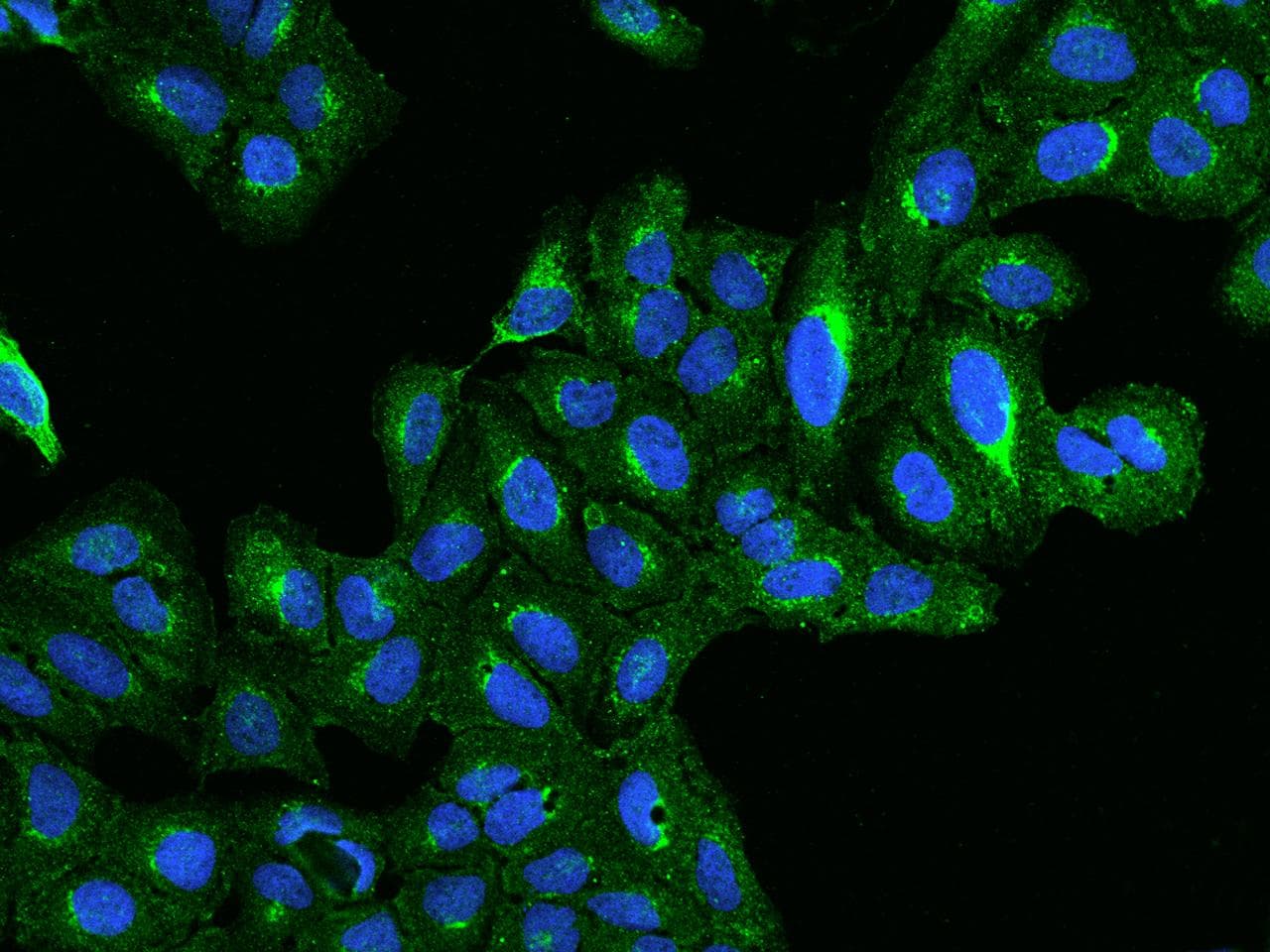 Polyclonal Rabbit anti-Human BET1L / GS15 Antibody (IF)