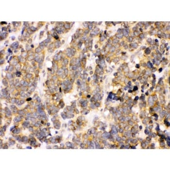 PDPK1 / PDK1 Antibody (aa524-556)