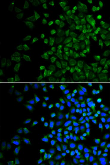 Polyclonal Rabbit anti-Human BAK1 / BAK Antibody (IHC, IF, WB)