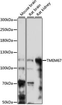 Polyclonal Rabbit anti-Human TMEM67 Antibody (WB)