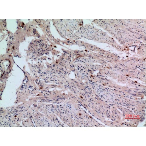 RFC1 / RFC Antibody (1071-1120 aa, C-terminal)