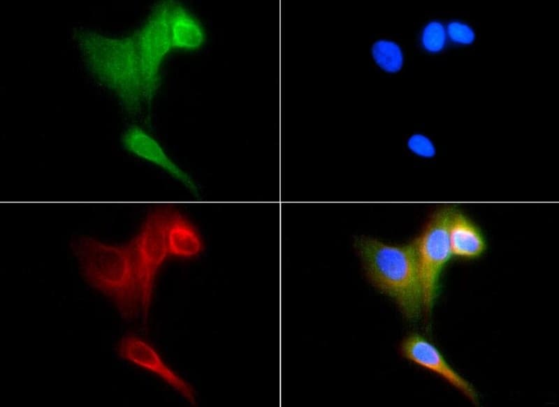 Heat Shock Protein 70 / HSPA1A Antibody