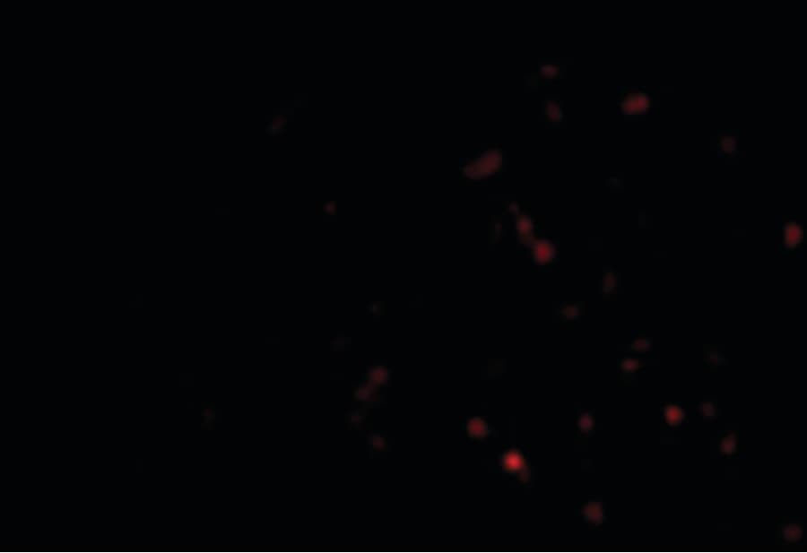 IHC-plus™ TP1 / TEP1 Antibody