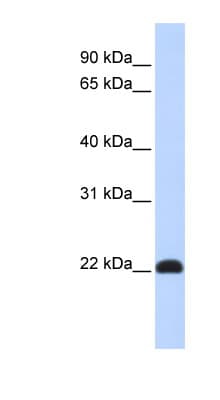 Polyclonal Rabbit anti-Human KLF16 Antibody (aa35-84, WB)