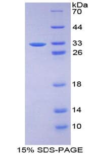 Human FBN3 Protein (Recombinant His-T7)