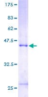 Human MCTS1 Protein (Recombinant GST)