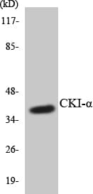 CSNK1A1 / CK1 Alpha Antibody (aa109-158)