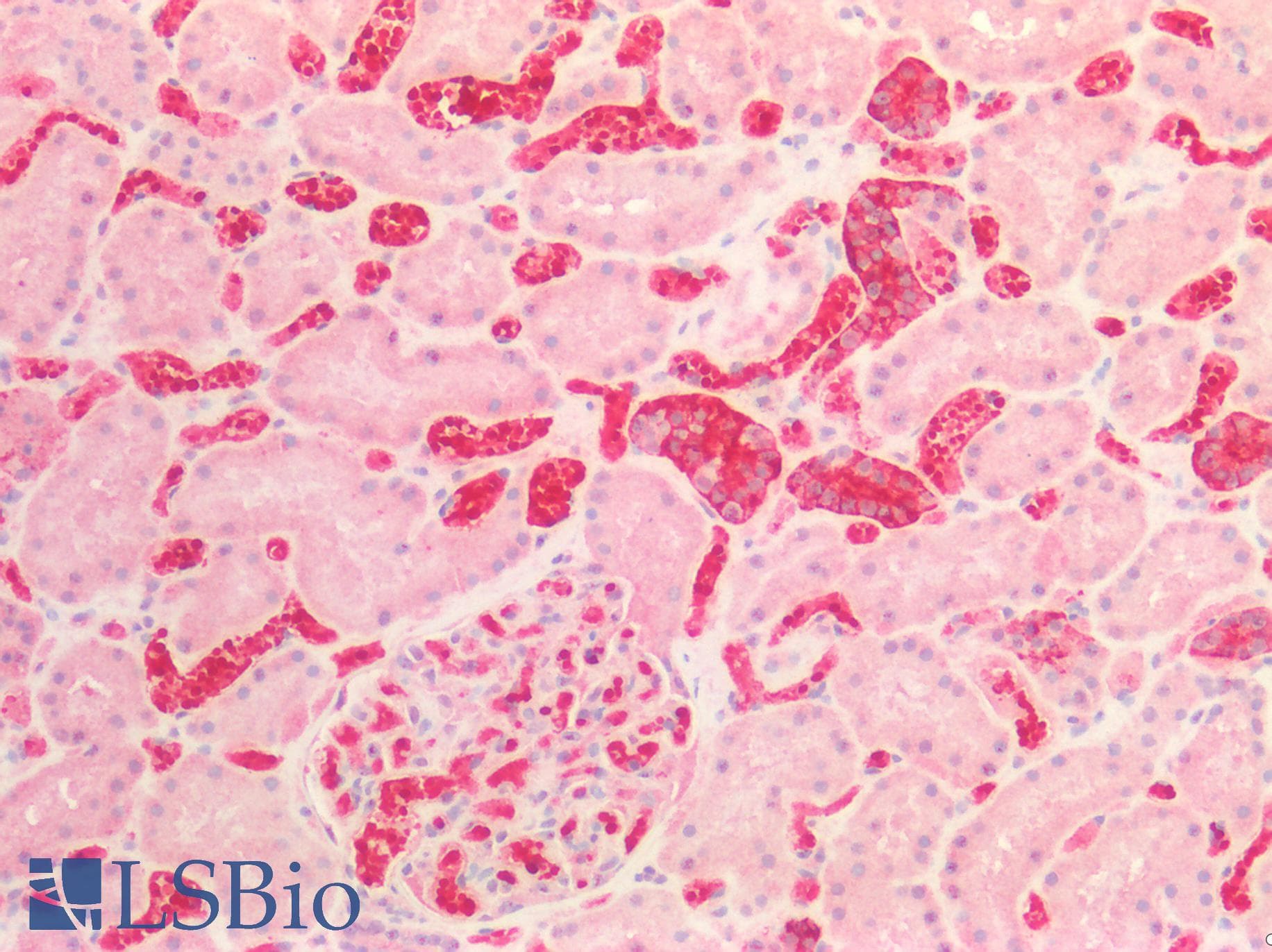 Monoclonal Mouse anti-Human ST6GAL1 / CD75 Antibody (clone LN-1, IHC)