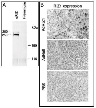 PRDM2 / RIZ1 Antibody