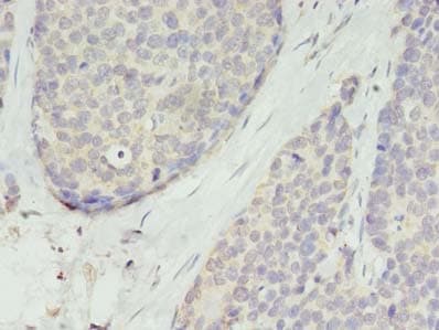 TMEM45A Antibody