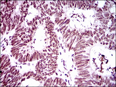Monoclonal Mouse anti-Human RING1 Antibody (clone 8C12F4, aa79-263, IHC, WB)