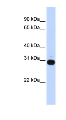 Vasohibin 1 / VASH1 Antibody (aa108-157)