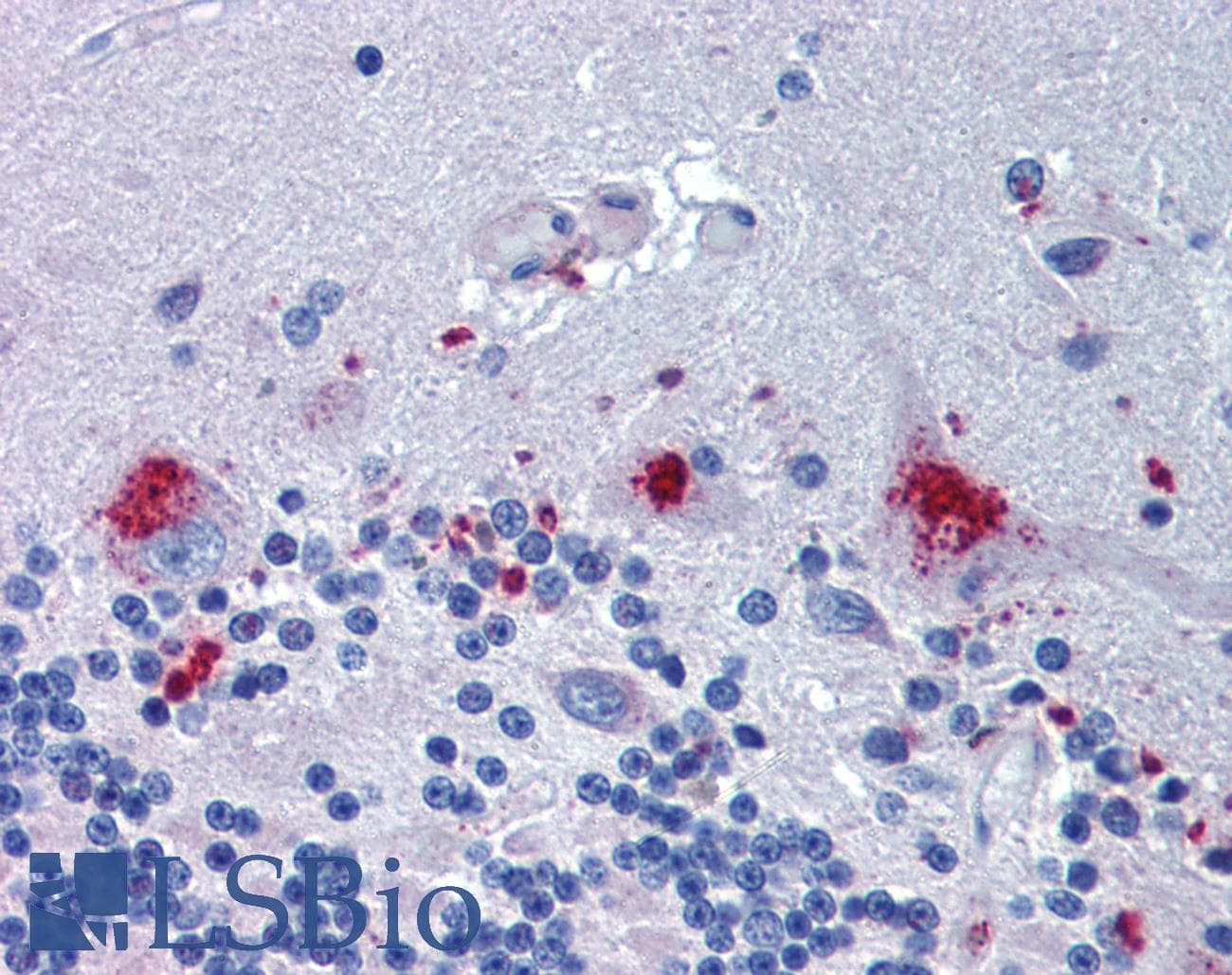 IHC-plus™ Polyclonal Rabbit anti-Human C14orf1 Antibody (Internal, IHC)