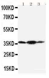 PDPN / Podoplanin Antibody (aa226-238)