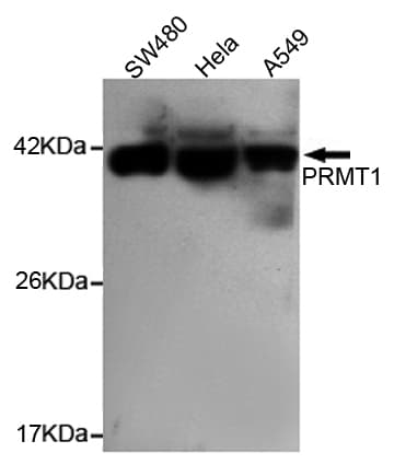 Monoclonal Mouse anti-Human PRMT1 Antibody (WB)