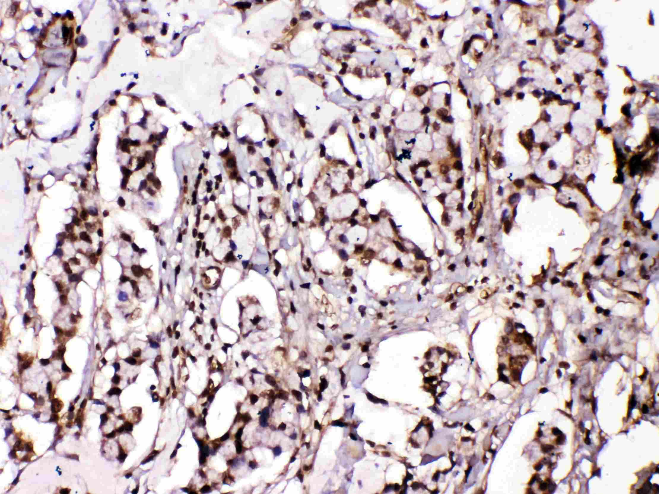 ISLET-1 / ISL1 Antibody