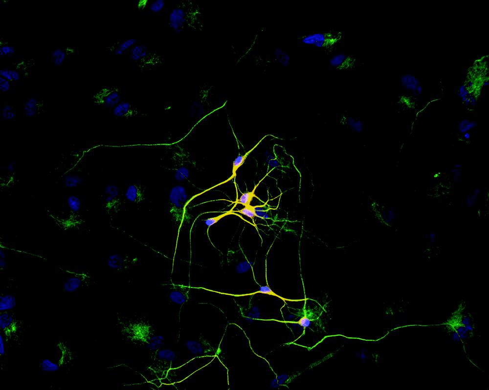 IHC-plus™ Monoclonal Mouse anti-Human TUBB3 / Tubulin Beta 3 Antibody (clone TU-20, C-Terminus, IHC, WB)