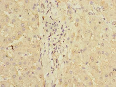 Polyclonal Rabbit anti-Human PDCL2 Antibody (IHC, WB)