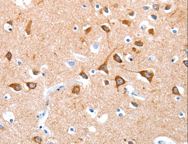 Polyclonal Rabbit anti-Human BMP4 Antibody (IHC, WB)