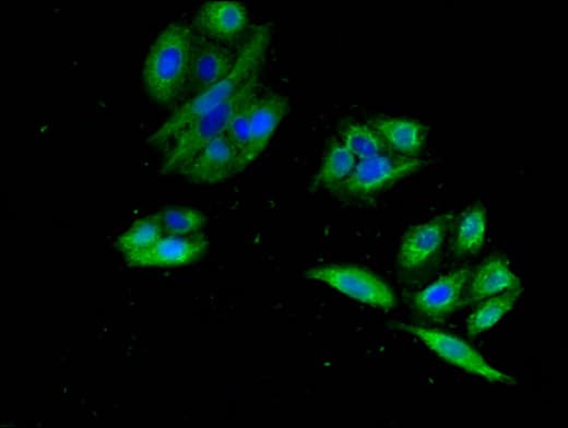 Polyclonal Rabbit anti-Human GPR22 Antibody (IF, WB)
