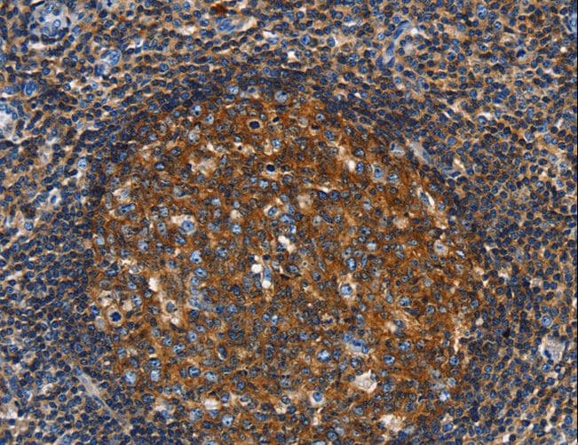 Polyclonal Rabbit anti-Human GNA13 Antibody (IHC, WB)