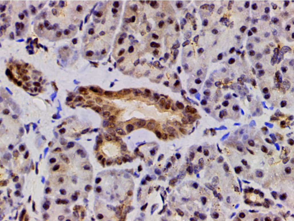 LIMK1 / LIMK Antibody (phospho-Thr508)