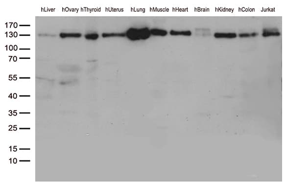 PECAM-1 / CD31 Antibody (clone UMAB30)