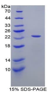 Human APOE / Apolipoprotein E (Recombinant His-T7)