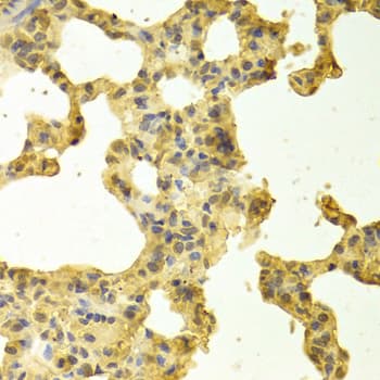 TRADD Antibody