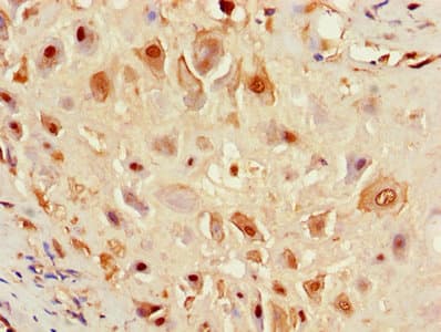 F8 / FVIII / Factor VIII Antibody