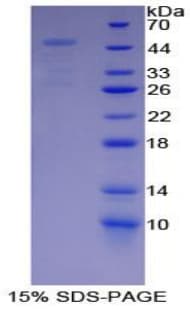 Human PSMD13 Protein (Recombinant His-T7)