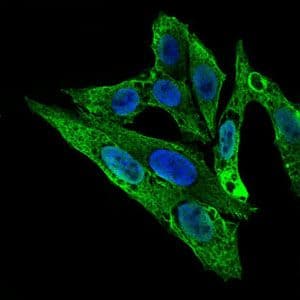 ARHGDIA / RHOGDI Antibody (Amino Acid: FULL 1-204, clone 2G3)