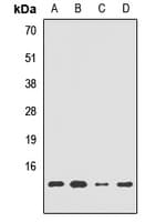 Polyclonal Rabbit anti-Human HRSP12 / UK114 Antibody (WB)