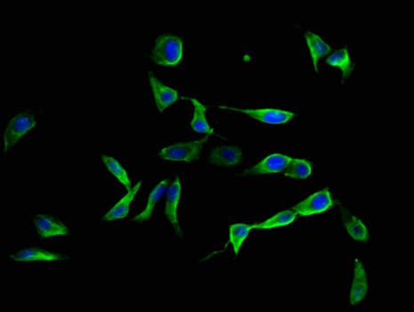 Fibulin-3 / EFEMP1 Antibody