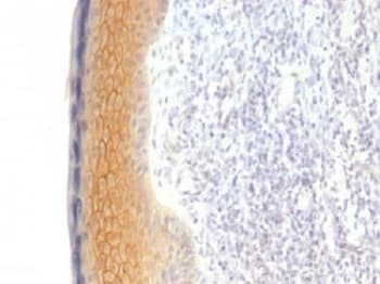 JUP/CTNNG/Junction Plakoglobin Antibody (clone CTNG/1483)