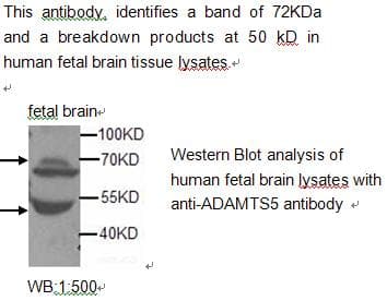 Polyclonal Rabbit anti-Human ADAMTS5 Antibody (WB)