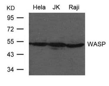 Polyclonal Rabbit anti-Human WAS / WASP Antibody (WB)