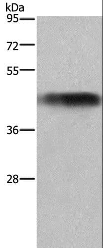 Polyclonal Rabbit anti-Human GALT Antibody (IHC, WB)
