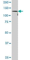 IHC-plus™ ASAP1 Antibody (clone 1B5)