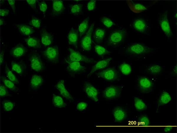 IHC-plus™ Monoclonal Mouse anti-Human GMEB1 Antibody (clone 2A8, IHC, IF, WB)